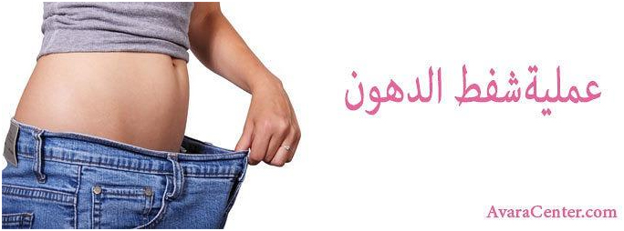شفط الدهون - افضل طريقة للتخلص من دهون الجسم