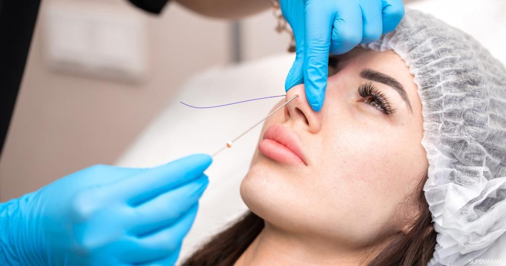 تجميل الانف بالخيوط <strong>في مصر</strong> 2 تجميل الانف بالخيوط