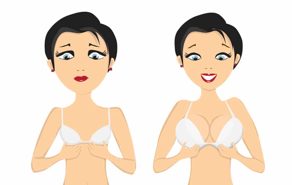 عملية شد الثدي (تنسيق الثديين - عملية تجميل الصدر) 1 عملية شد الثدي